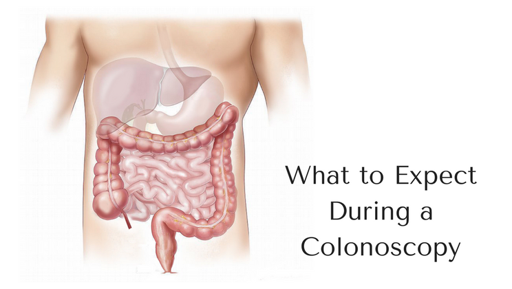 everything you need to know about having a colonoscopy alltop viral